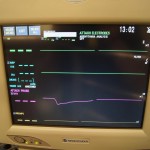 Nihon Kohden 2301 Bedside Monitor for Sale